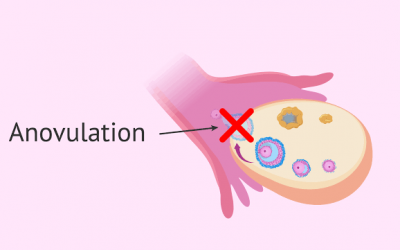 Reasons Why You May Not Be Ovulating