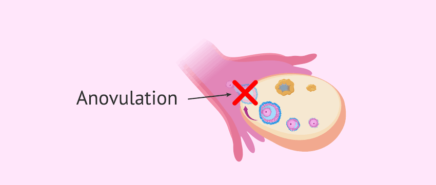 Reasons Why You May Not Be Ovulating
