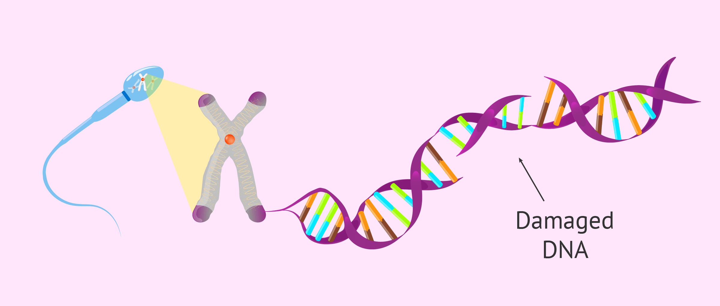 Sperm DNA Fragmentation?