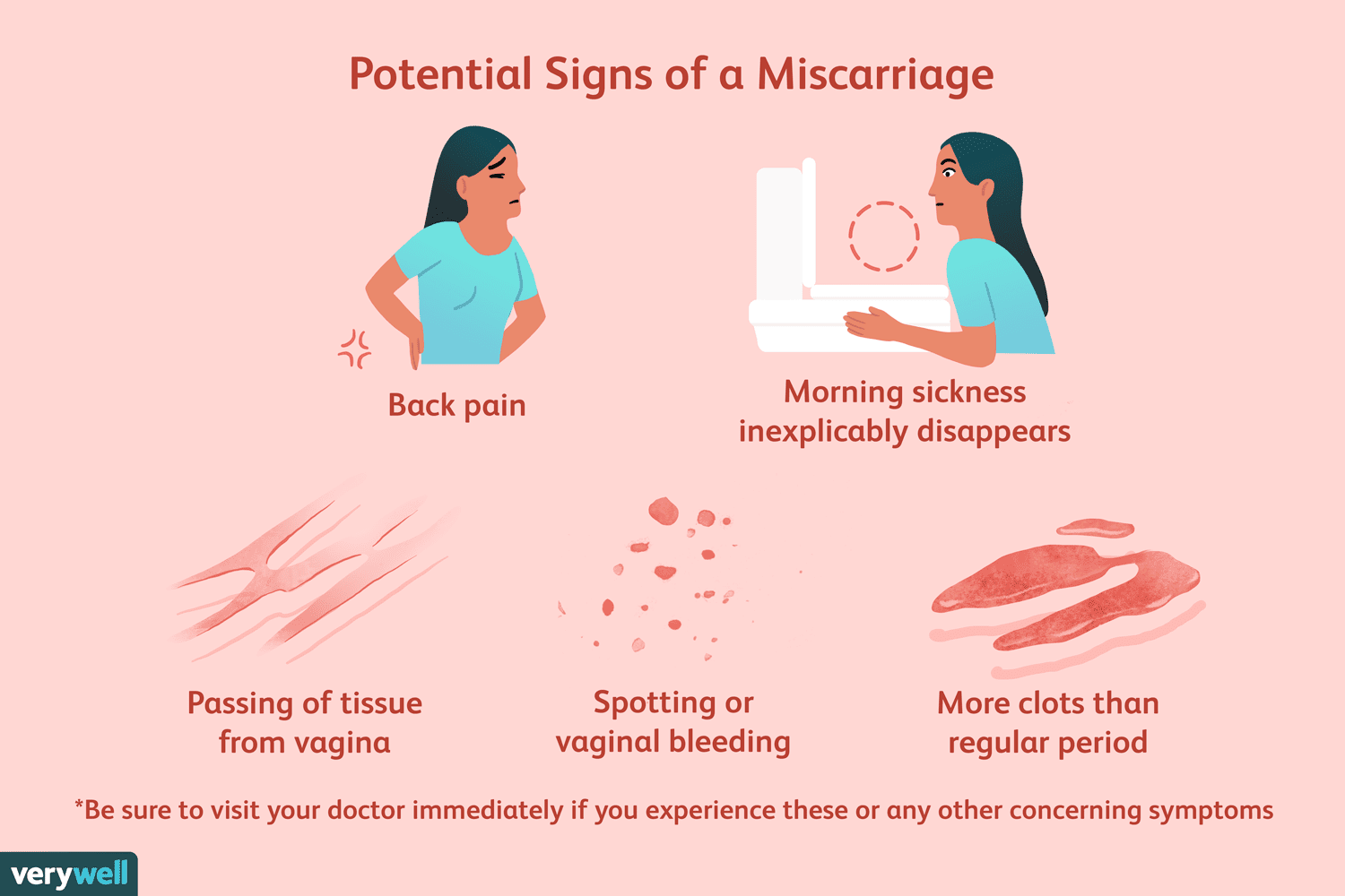 Signs of a miscarriage
